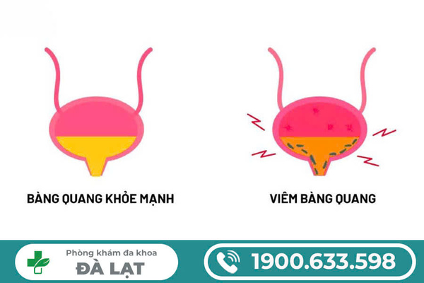 Hình ảnh minh họa